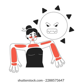 Sunburn redness monochrome concept vector spot illustration. Editable 2D flat bw cartoon character for web UI design. Girl with skin red spots creative linear hero image for landings, mobile headers