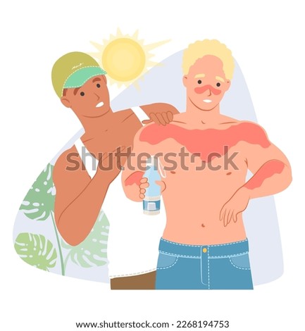 Sunburn vector. Cartoon man helping friend with damaged skin applying sun lotion sunblock and sunscreen with SPF. Skincare and protection during sunbathing on beach illustration