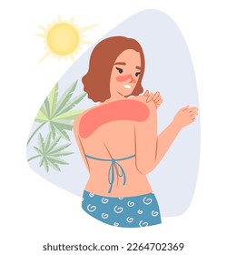 Sunburn vector. Young woman caring of redness shoulders flat cartoon illustration. Girl using sunscreen getting sunburned. Healthy skin concept