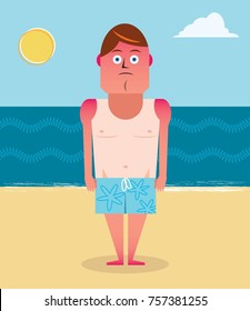 Sunburnt Man On Beach