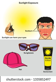 Sunlight Exposure infographic diagram showing how it harm human eye and face with sunburn also how to avoid it using sunglasses hat and sunscreen for science education