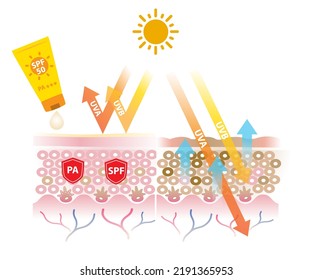 Sunscreen with PA and  SPF block UVA and UVB rays vector on white background. Comparison of skin layer with suncreen and without sunscreen. Skin care and beauty concept illustration.