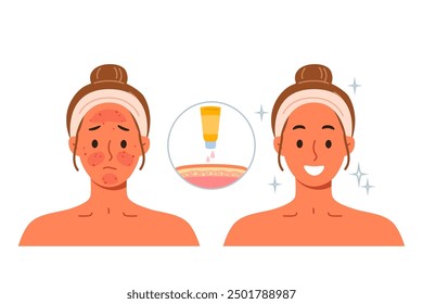 Sunscreen that protects skin from burns and solar radiation, next to girls demonstrating results before and after. Sunscreen for solarium visitors or tourists vacationing in tropical countries