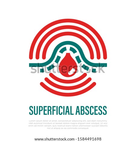 Superficial abscess thin line icon. Pus under skin, inflammation and pain. Furuncle, pustule, acne. Vector illustration.