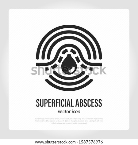 Superficial abscess thin line icon. Pus under skin, inflammation and pain. Furuncle, pustule, acne. Vector illustration.
