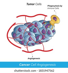 Supply Of Oxygen And Nutrients To Tumor/cancer Cells Lead To Proliferation, Metastasis And Angiogenesis , Concept Of Phagocytosis Of Cancer Cell By Immune Cell. In White Background Vector Concept