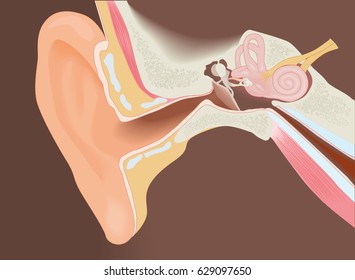 Surfer's ear, exostosis - section of the ear - diagram