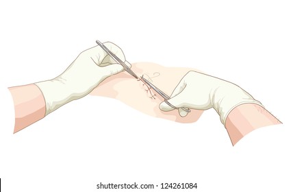 The surgeon takes in a wound. Vector illustration.