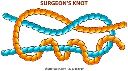 Surgeons knot isolated on white. Binding and fastening unit for permanent bracing. Modification of straight knot where first loop makes two turns. Node is tied under tension. Twisted brown tape