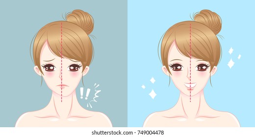  Surgery Woman Asymmetry Chin Before And After On The Blue Background