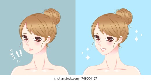 surgery woman with tip chin before and after on the blue background