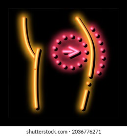 surgical ass enlargement neon light sign vector. Glowing bright . transparent symbol illustration