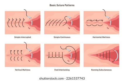 Surgical stitches patterns. Stitching methods and shapes. Tissues and skin surgical stitching. Flat vector illustration