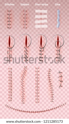 Surgical suture stitches realistic set of images on transparent background with different shapes of medical stitching vector illustration