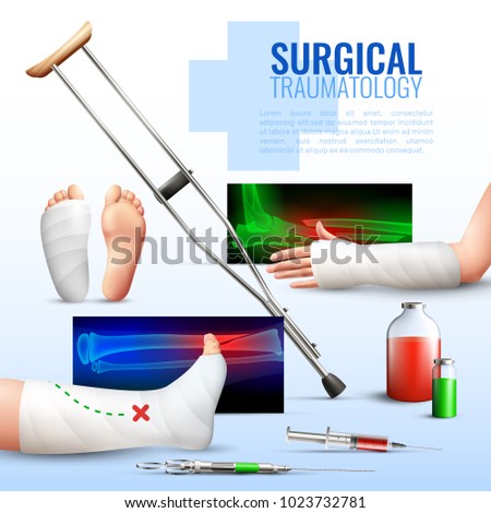 Surgical traumatology realistic concept with hand foot and leg injury symbols vector illustration