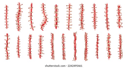 Suture-Symbole setzen Cartoon-Vektorgrafik. Wunde chirurgisch. Arztstillung