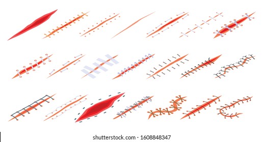 Suture icons set. Isometric set of suture vector icons for web design isolated on white background