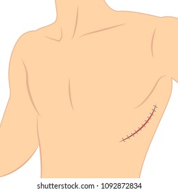 Suture vector. lesion. body vector. free space for text. wallpaper. background.