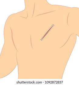 Suture vector. lesion. body vector. free space for text. wallpaper. background.