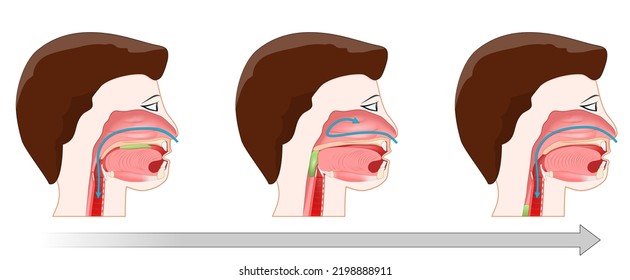 Swallowing Process Deglutition After Form Bolus Stock Vector (Royalty ...