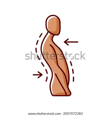 Swayback posture RGB color icon. Spine curvature disorder. Poor posture. Postural deformity. Backward thoracic spine movement. Ligament sprain. Muscle imbalances. Isolated vector illustration