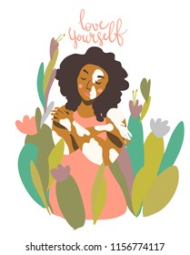 Sweet trendy pieceful image, self acceptance, body positivity. Woman with vitiligo skin condition. Love yourself lettering. Motivation vector art in minimal style.