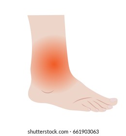 Swelling of the feet and ankles from infected or injury