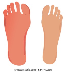 Swelling of the feet and ankles. Vector about medical.