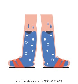 Swelling Of The Feet. Swollen Ankles And Feet. Vector Flat Illustration On White Background