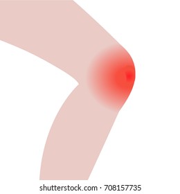 Swelling of the knee  from infected or injury vector illustration