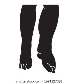 Swollen Of The Foot, Ankle And Leg Concept Vector Icon Design, Swelling Edema On White Background, 