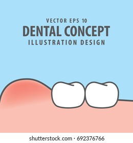 Swollen gums with teeth illustration vector on blue background. Dental concept.