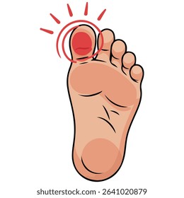 Swollen stubbed toe injury isolated vector illustration on white background