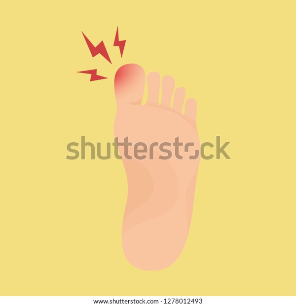 Swollen toe cartoon vector. free space for text.\
wallpaper. copy space.