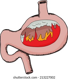 Symbol of acid reflux indigestion with flames in stomach