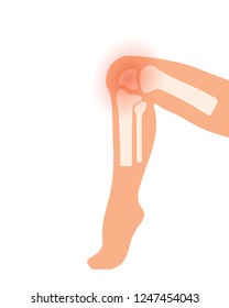 symbol of knee joint bones for orthopedic