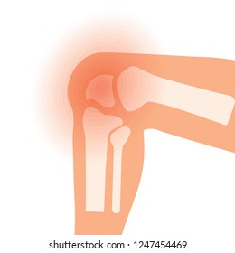 symbol of knee joint bones for orthopedic
