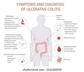Síntoma de colitis ulcerosa, vector, diagrama médico