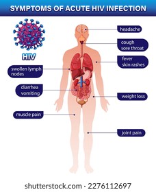 Síntomas de infección aguda por VIH