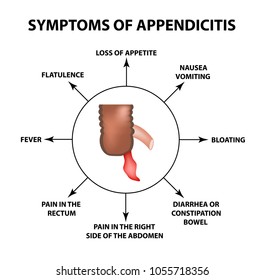 Symptoms Appendicitis Inflammation Appendix Infographics Vector Stock ...