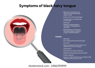 Symptoms of black hairy tongue, medical information with illumination 