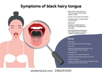 Symptoms of black hairy tongue, medical information, zoom illustration 