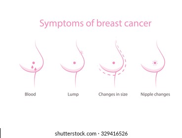 Symptoms of breast cancer. Icon set info graphic. Skin symptoms of breast cancer, self examination, tumor, body exam