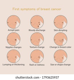 Symptoms of breast cancer. Medicine, pathology, anatomy, physiology, health. Infographic. Vector illustration. Healthcare poster or banner template