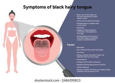 Symptoms and causes of black hairy tongue, medical information