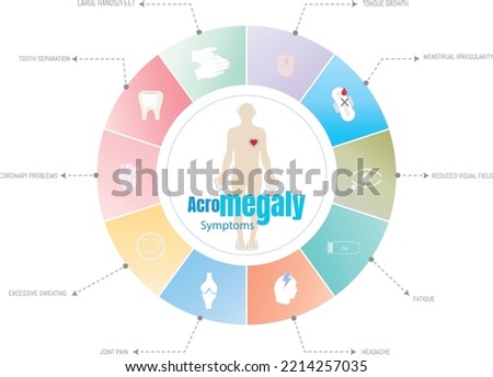 Symptoms characterizing the disease ,acromegaly