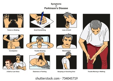 Symptoms of Parkinson’s Disease infographic diagram including tremor or shaking small handwriting loss of smell constipation dizziness stooping and more for medical science education and health care