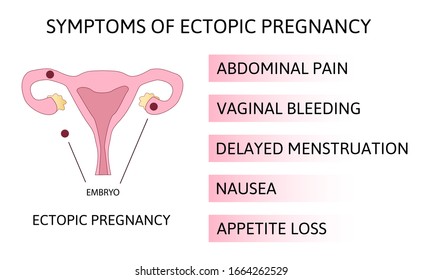 Hand Drawn Female Reproductory System Anatomy Stock Vector (Royalty ...