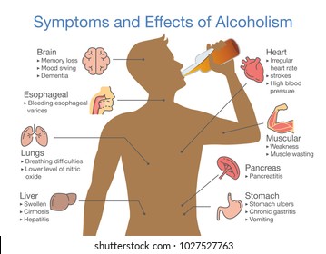 Symptoms and effects of alcoholism patient. Illustration about health problem of people with alcohol addiction.