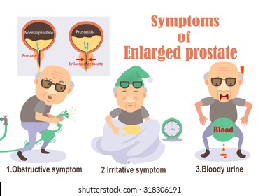 Symptoms Enlarged Prostate Infographicvector Illustration Stock Vector ...